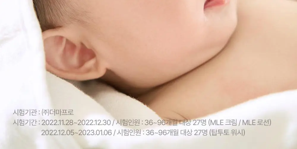 [선물기획] 아토팜 에센셜 세트(로션200ml+워시300ml)+(로션20ml+크림8ml) 상세페이지 8